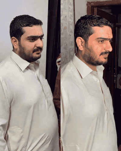 Mr. Zahid before and after transformation