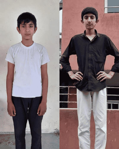 Apex Height transformation — Verified Parent · Sargodha