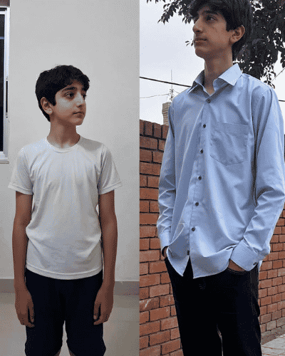 Apex Height transformation — Verified Parent · Quetta