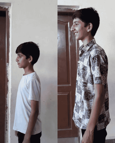 Apex Height transformation — Verified Parent · Multan