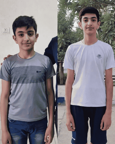 Apex Height transformation — Verified Parent · Peshawar